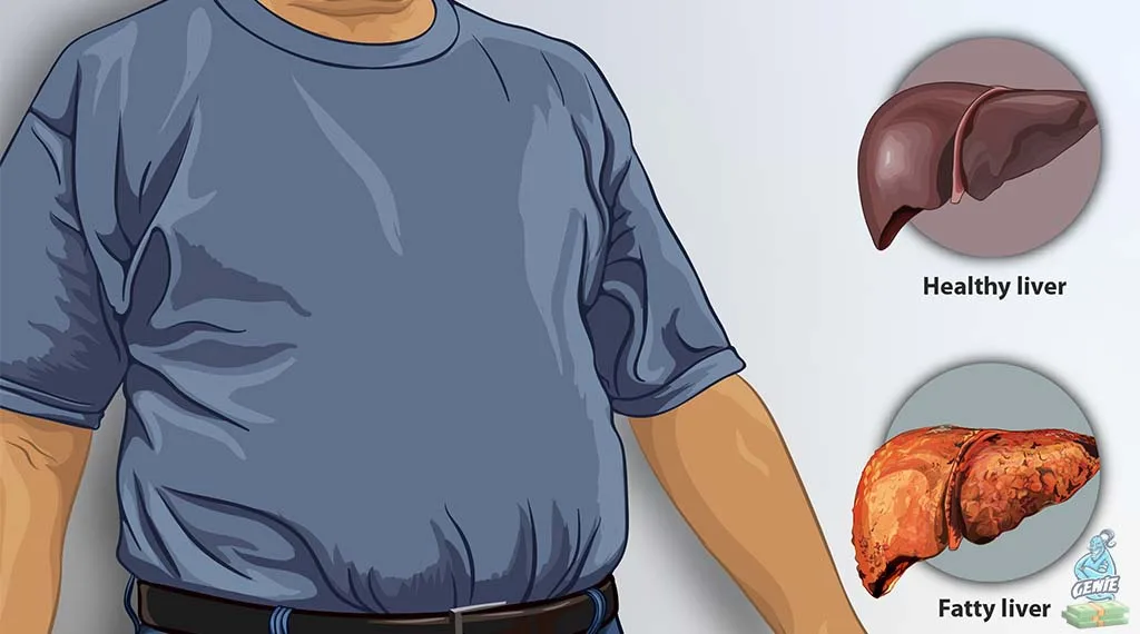 What Can You Donate To Get Money? How much money do i get for donating a liver
